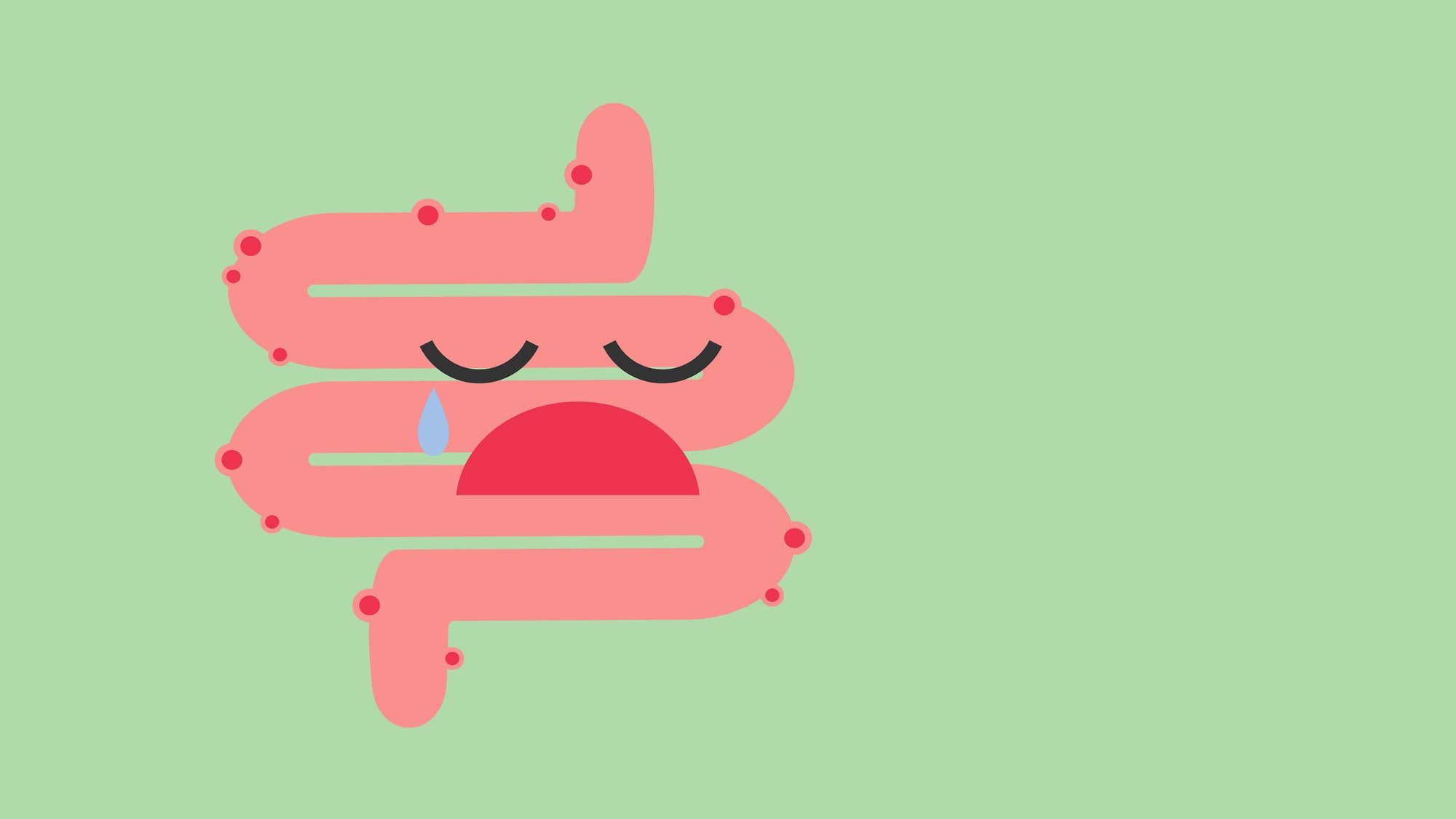 Diverticulitis 101: What You Need to Know