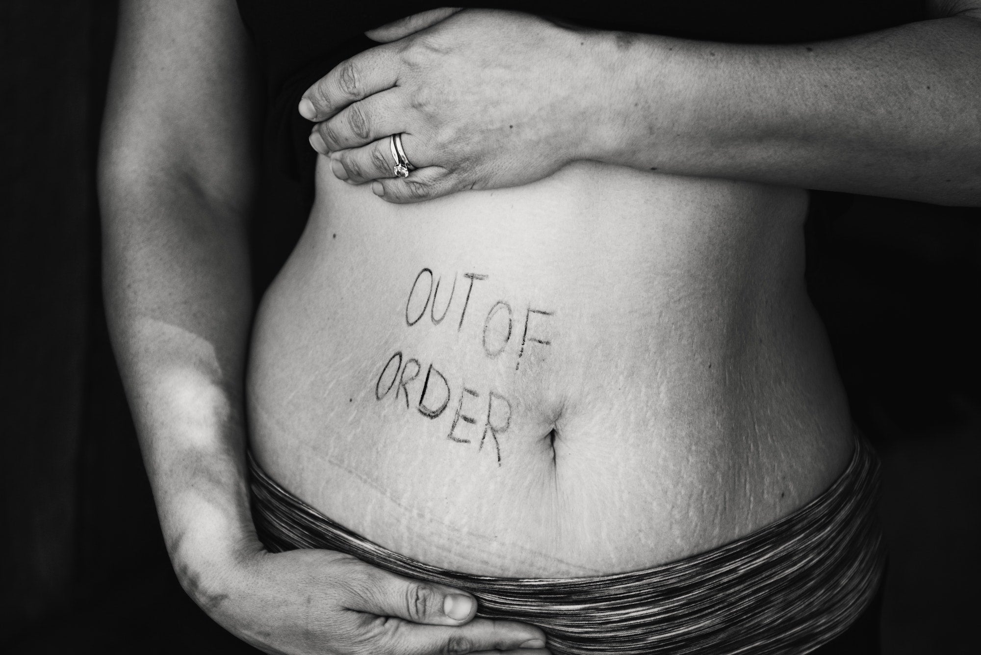 Crohn's Disease 101: What You Need to Know